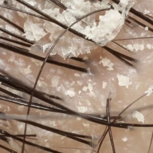 Probleminei galvos odai